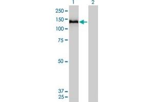 Western Blot analysis of COL6A2 expression in transfected 293T cell line by COL6A2 monoclonal antibody (M01), clone 2C5-F2.