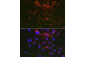 Immunofluorescence analysis of RD cells using PRK Rabbit pAb (ABIN6129909, ABIN6146189, ABIN6146191 and ABIN6218391) at dilution of 1:150 (40x lens). (PRKAG3 antibody  (AA 1-210))