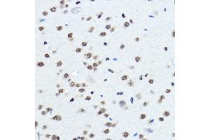 Immunohistochemistry of paraffin-embedded mouse brain using BOP1 Rabbit pAb (ABIN7265887) at dilution of 1:100 (40x lens). (BOP1 antibody  (AA 600-680))
