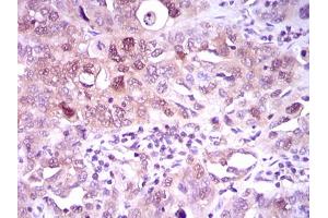 Image no. 2 for anti-ATP Citrate Lyase (ACLY) antibody (ABIN1491378) (ACLY antibody)