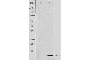 Western blot analysis of extracts from HeLa cells using COX17 antibody. (COX17 antibody  (N-Term))