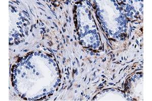 Immunohistochemical staining of paraffin-embedded Human liver tissue using anti-QPRT mouse monoclonal antibody.