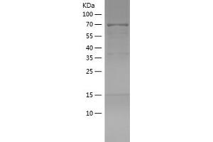 EH Domain Binding Protein 1 (EHBP1) (AA 812-1160) protein (His-IF2DI Tag)