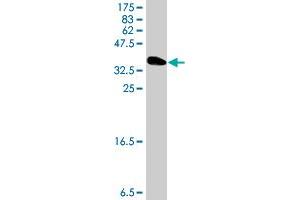 Western Blot detection against Immunogen (35. (Epiregulin antibody  (AA 32-117))