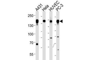Epidermal Growth Factor Receptor antibody western blot analysis in A431, HeLa, HUVEC, PC3 lysate (EGFR antibody  (AA 1070-1099))