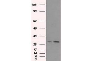 TIPRL antibody