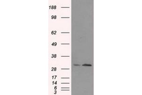 TIPRL antibody