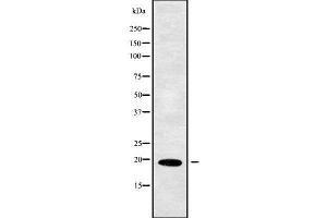 Western blot analysis of PPP3R1 using MCF7 whole cell lysates (PPP3R1 antibody  (Internal Region))