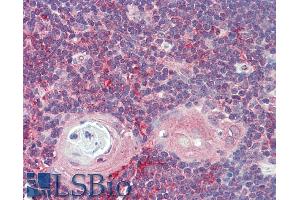 ABIN5539807 (5µg/ml) staining of paraffin embedded Human Thymus. (ARF4 antibody  (AA 137-150))