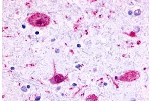 Anti-GPR17 antibody  ABIN1048754 IHC staining of human brain, neurons and glia.
