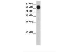 Image no. 2 for anti-Zinc Finger Protein 16 (ZNF16) (N-Term) antibody (ABIN6736214) (ZNF16 antibody  (N-Term))