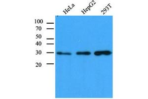 Western Blotting (WB) image for anti-Carbonyl Reductase 1 (CBR1) antibody (ABIN614308)