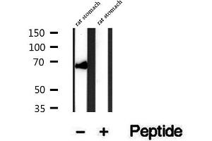 Western blot analysis of extracts of rat stomach tissue, using SYVN1 antibody. (SYVN1 antibody  (Internal Region))