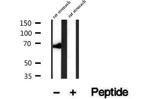 Western blot analysis of extracts of rat stomach tissue, using SYVN1 antibody.