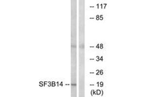 Western blot analysis of extracts from HepG2 cells, using SF3B14 Antibody. (Pre-mRNA Branch Site Protein p14 (SF3B14) (AA 76-125) antibody)