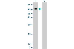 Western Blotting (WB) image for anti-Integrin beta 5 (ITGB5) (AA 421-516) antibody (ABIN561556)