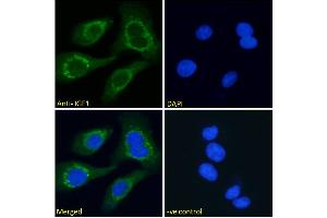 ABIN571240 Immunofluorescence analysis of paraformaldehyde fixed HEK293 cells, permeabilized with 0. (IGF1 antibody  (Internal Region))