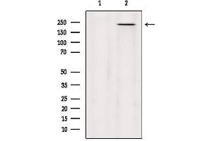 Western blot analysis of extracts from Hela, using MYO5C Antibody. (MYO5C antibody)