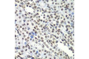 Immunohistochemistry of paraffin-embedded rat kidney using SF3B2 antibody. (SF3B2 antibody  (AA 616-895))