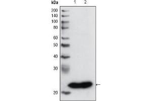 Western Blot showing using GSTP1 antibody used against PC3 cell lysate (1) and human cerebellum tissue lysate (2). (GSTP1 antibody)