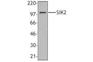 Western Blotting (WB) image for anti-Salt-Inducible Kinase 2 (SIK2) antibody (ABIN2666364) (SIK2 antibody)
