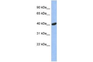 WB Suggested Anti-SIAH2 Antibody Titration: 0. (SIAH2 antibody  (Middle Region))