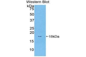 Western Blotting (WB) image for anti-Bone Morphogenetic Protein Receptor, Type II (serine/threonine Kinase) (BMPR2) (AA 27-150) antibody (ABIN1858163)