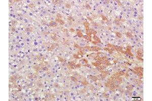 Paraformaldehyde-fixed, paraffin embedded rat liver, Antigen retrieval by boiling in sodium citrate buffer (pH6) for 15min, Block endogenous peroxidase by 3% hydrogen peroxide for 30 minutes,  Blocking buffer (normal goat serum) at 37°C for 20min, Antibody incubation with Protein S Polyclonal Antibody (bs-9512R) at 1:400 overnight at 4°C, followed by a conjugated secondary and DAB staining. (PROS1 antibody  (AA 245-295))