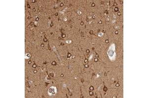 Immunohistochemical staining of human cerebral cortex with RRP15 polyclonal antibody  shows strong cytoplasmic positivity in neuronal cells at 1:200-1:500 dilution. (RRP15 antibody)