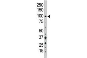 The FGFR2 polyclonal antibody  is used in Western blot to detect FGFR2 in Jurkat cell lysate.