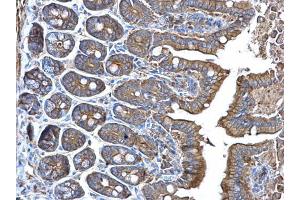 IHC-P Image alpha Adducin antibody detects alpha Adducin protein at membrane on mouse intestine by immunohistochemical analysis. (alpha Adducin antibody)