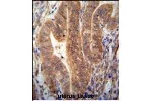 KI antibody (N-term) (ABIN654385 and ABIN2844131) immunohistochemistry analysis in formalin fixed and paraffin embedded human uterus tissue followed by peroxidase conjugation of the secondary antibody and DAB staining. (SHISAL1/KIAA1644 antibody  (N-Term))