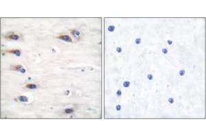 Immunohistochemistry analysis of paraffin-embedded human brain, using KSR (Phospho-Ser392) Antibody. (KSR1 antibody  (pSer404))