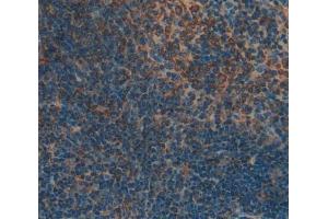 Used in DAB staining on fromalin fixed paraffin- embedded Kidney tissue (LSP1 antibody  (AA 126-330))