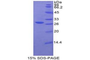 SDS-PAGE analysis of Human Glucuronidase beta Protein. (Glucuronidase beta Protein)