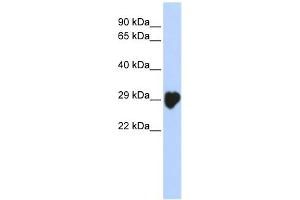 Carbonic Anhydrase I antibody used at 1 ug/ml to detect target protein. (CA1 antibody  (N-Term))