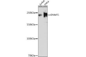 Western blot analysis of extracts of various cell lines, using DNMT1 antibody (ABIN7266808) at 1:1000 dilution. (DNMT1 antibody)