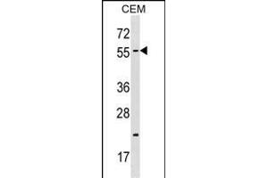 CBX4 Antibody (N-term) (ABIN1538811 and ABIN2848679) western blot analysis in CEM cell line lysates (35 μg/lane).