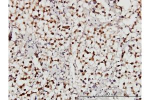 Immunoperoxidase of monoclonal antibody to USP34 on formalin-fixed paraffin-embedded human seminoma. (USP34 antibody  (AA 3296-3395))