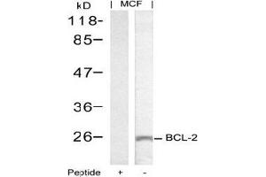 Image no. 2 for anti-B-Cell CLL/lymphoma 2 (BCL2) (Ser70) antibody (ABIN197204) (Bcl-2 antibody  (Ser70))