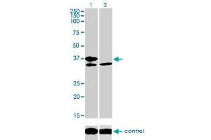 Western blot analysis of TCF19 over-expressed 293 cell line, cotransfected with TCF19 Validated Chimera RNAi (Lane 2) or non-transfected control (Lane 1).