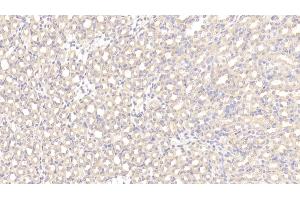 Immunohistochemistry (IHC) image for anti-Tumor Necrosis Factor Receptor Superfamily, Member 11b (TNFRSF11B) (AA 22-281) antibody (ABIN7431047)