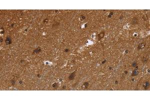 Immunohistochemistry of paraffin-embedded Human brain using FRK Polyclonal Antibody at dilution of 1:50 (FRK antibody)