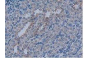 Detection of AQP4 in Rat Kidney Tissue using Polyclonal Antibody to Aquaporin 4 (AQP4) (Aquaporin 4 antibody  (AA 179-314))