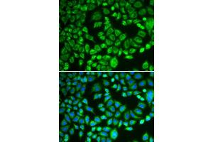 Immunofluorescence analysis of MCF-7 cells using PSMD7 antibody. (PSMD7 antibody  (AA 1-324))