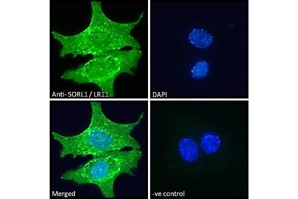 SORL1 antibody  (C-Term)