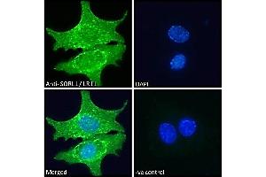 ABIN184579 Immunofluorescence analysis of paraformaldehyde fixed HepG2 cells, permeabilized with 0. (SORL1 antibody  (C-Term))