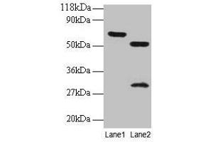 Western blot All lanes: ZNF384 antibody at 2 μg/mL Lane 1: EC109 whole cell lysate Lane 2: 293T whole cell lysate Secondary Goat polyclonal to rabbit IgG at 1/15000 dilution Predicted band size: 64, 57, 51 kDa Observed band size: 64, 51, 30 kDa (ZNF384 antibody  (AA 1-245))
