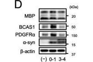 α-Syn PFF exposure to immature OLGs during differentiation-induced abnormal oligodendrogenesis. (BCAS1 antibody  (AA 542-584))