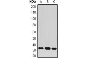 Western blot analysis of BCL10 expression in MCF7 (A), A549 (B), Jurkat (C) whole cell lysates. (BCL10 antibody)
